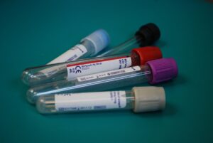 Blood collection tubes used for mobile phlebotomy and laboratory specimen collection in Rocklin, California.